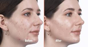 By Mi - Miracle Repair Collection 