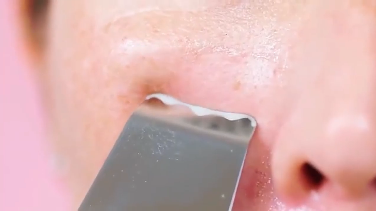 3-in-1 Ultrasonic Facial Skin Scrubber – Lifting, Moisturizing & Cleansing