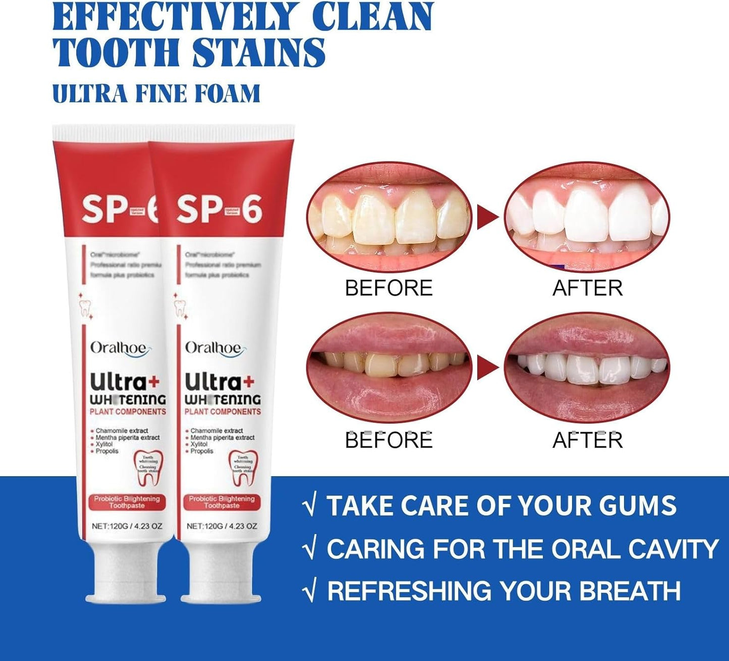 SP-6 Ultra Whitening Toothpaste