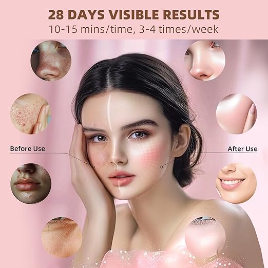 LED Mask – Clearer, Brighter, Youthful Skin