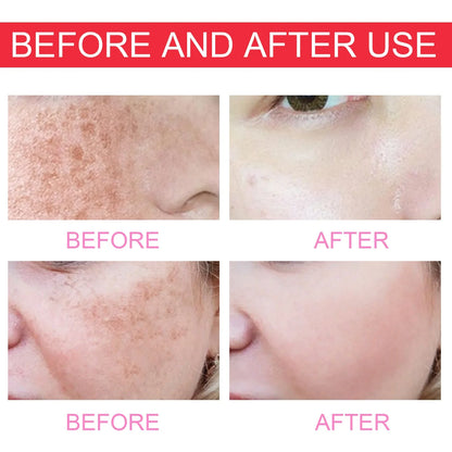 Brightening And Clearing Serum